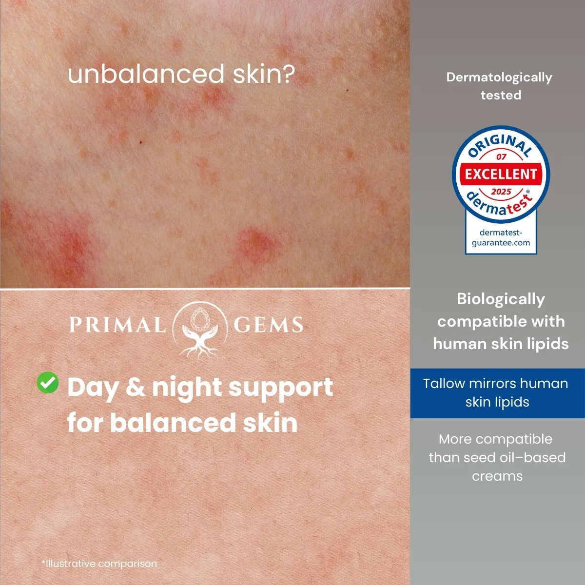 Comparison of imbalanced skin versus balanced skin supported by tallow-based skincare