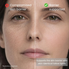 Comparison of weakened and strengthened skin barrier supported by skin-identical tallow lipids.