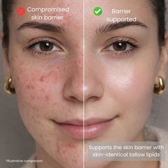 Comparison of weakened and strengthened skin barrier on a woman supported by skin-identical tallow lipids.